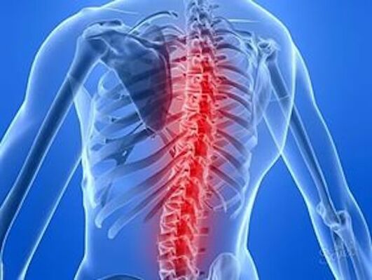 Spinal disorders cause back pain