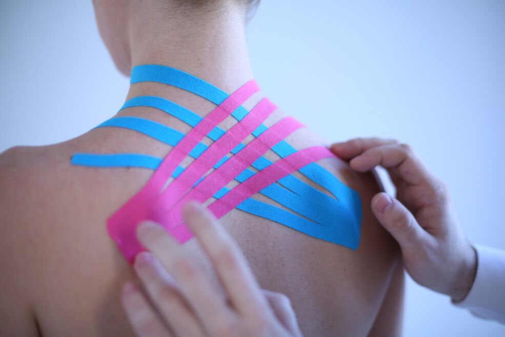 Kinesio taping for osteochondrosis of the spine