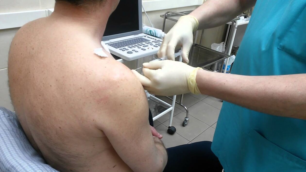 Injection in the shoulder for osteoarthritis